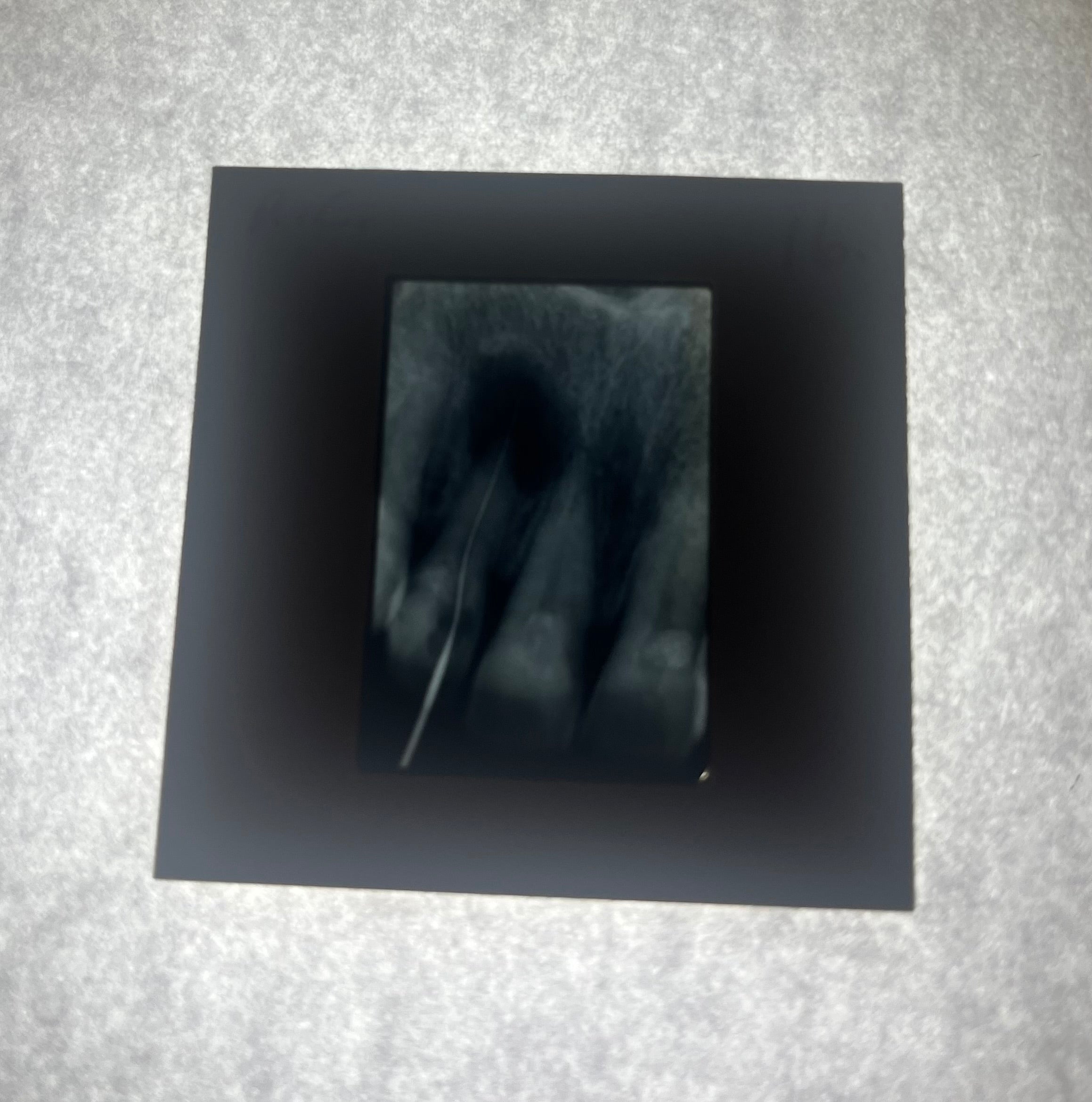 Dental X-Ray (Bitewing) Slide